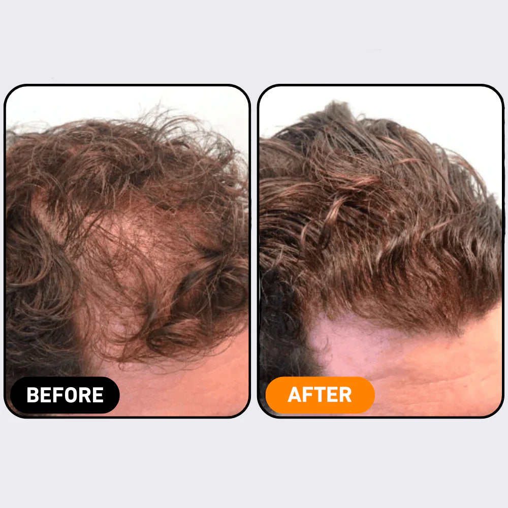 Wurzel Aktivierungs Shampoo